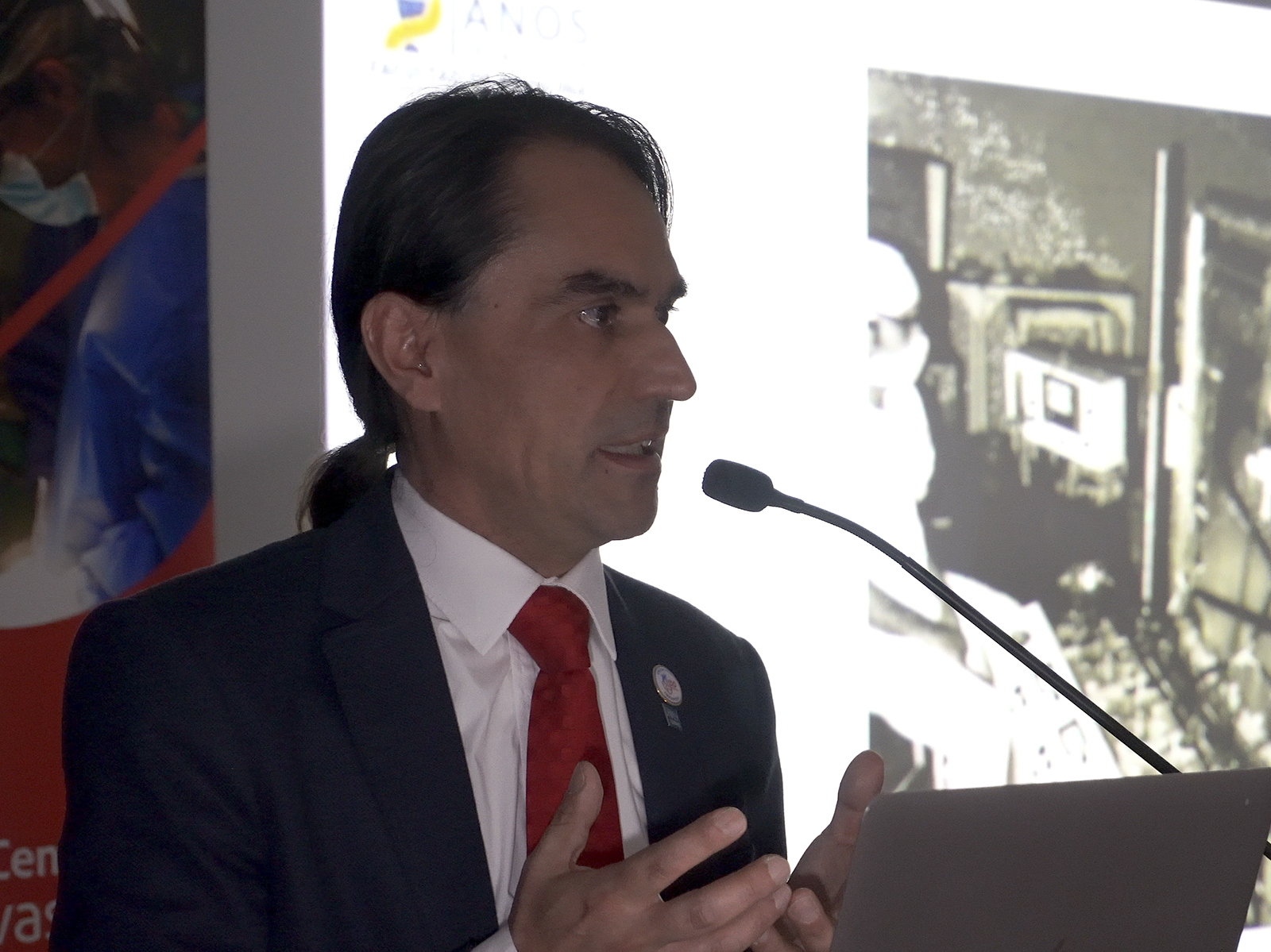 50 Años de cirugia cardiaca